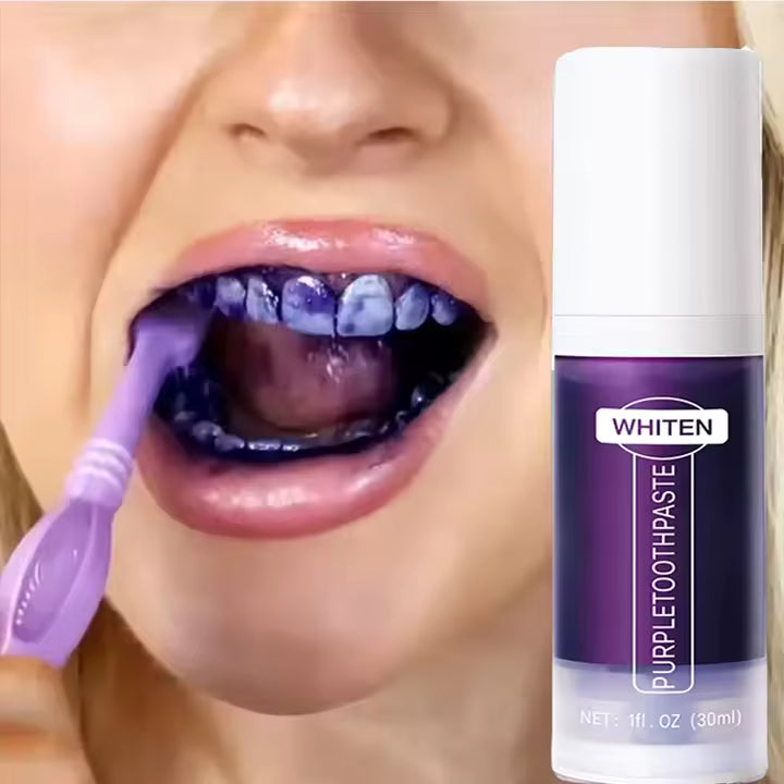 Ser de Albire a Dinților | V34 BrightSmile Zâmbet Radiant